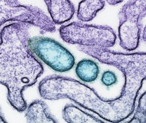 Electron microscope image of virus particles inside a host cell